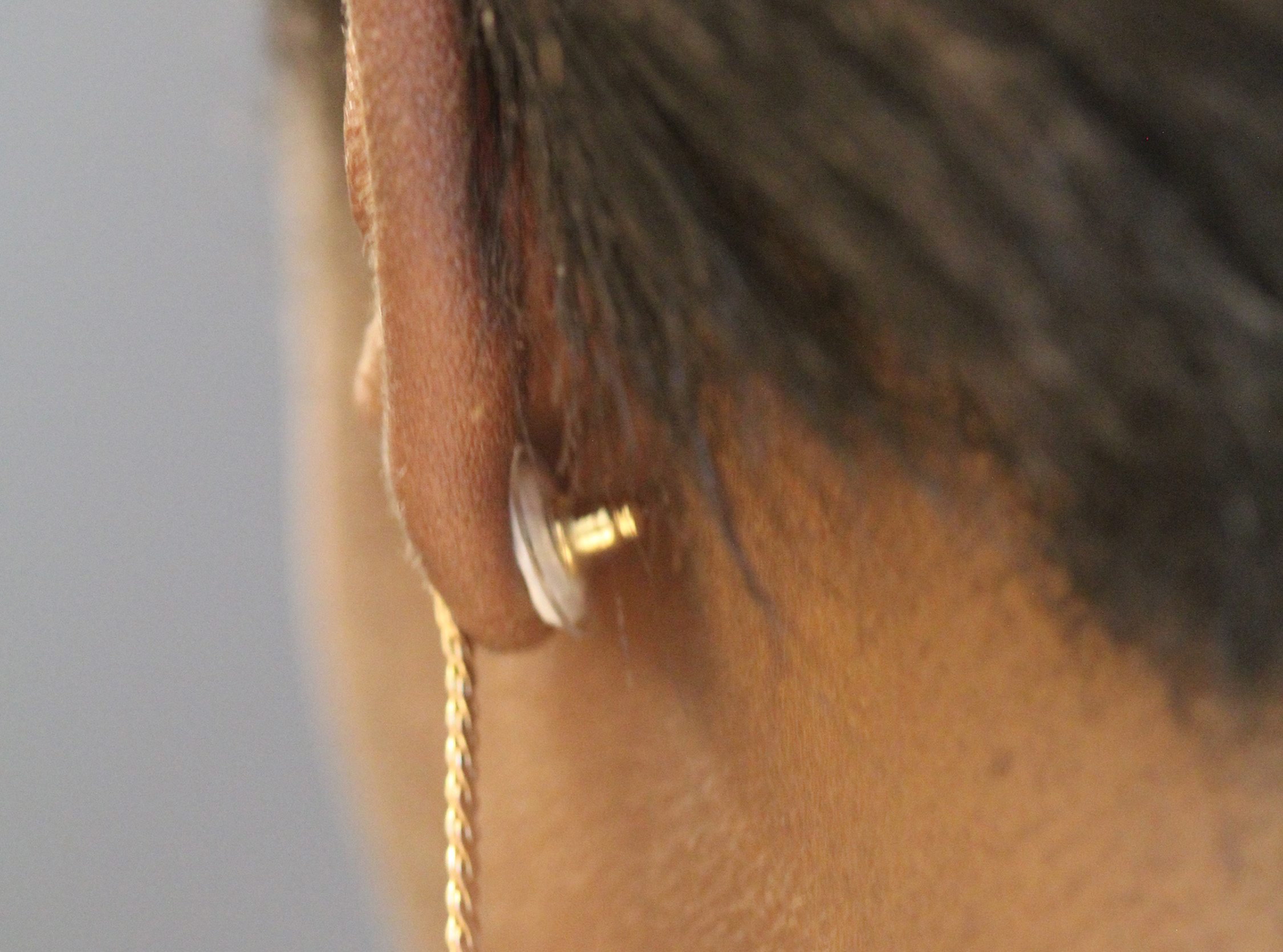 A contraceptive earring patch is shown as it would be worn on a woman’s ear. The white contraceptive patch can be seen attached to the earring back and adhered to the back of the ear. (Credit: Mark Prausnitz, Georgia Tech)