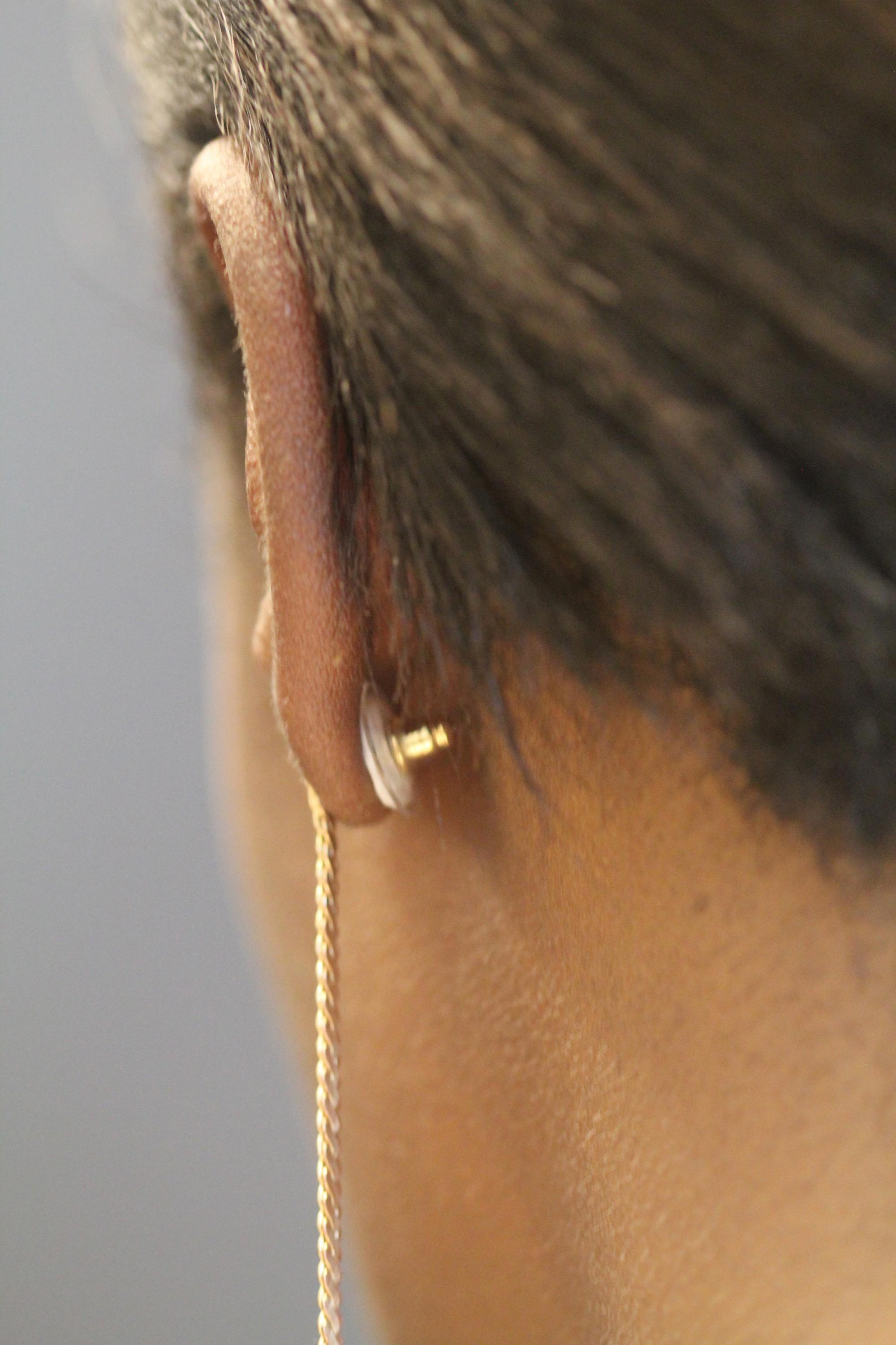 A contraceptive earring patch is shown as it would be worn on a woman’s ear. The white contraceptive patch can be seen attached to the earring back and adhered to the back of the ear. (Credit: Mark Prausnitz, Georgia Tech)
