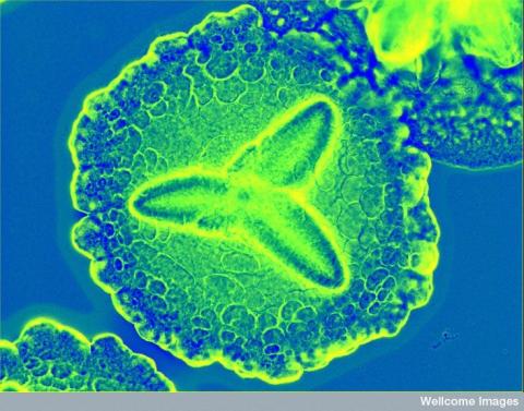 Bacteria behind acute periodontitis. Aggregatibacter actinomycetemcomitans most often lives peacefully in the mouth until circumstances lead it to become infectious. It forms flower-like colonies, here under a microscope sporting a colorful stain added by a researcher. Aa is gram-negative. Credit: Derren Ready (2012) CIL:38942, CIL. Dataset. https://doi.org/doi:10.7295/W9CIL38942 Creative Commons license