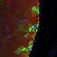  

Hydrogel delivered stem cells called muscle satellite cells integrate to form new muscle strands, in green, along with existing muscle tissue, in red. Yellow strands may descend from existing muscle cells and from delivered MuSCs.