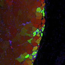 Hydrogel delivered stem cells called muscle satellite cells integrate to form new muscle strands, in green, along with existing muscle tissue, in red. Yellow strands may descend from existing muscle cells and from delivered MuSCs.